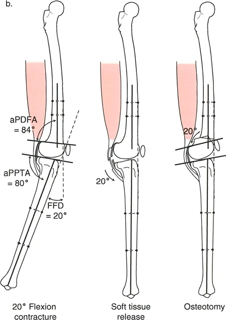 وصف طبي دقيق للمريض