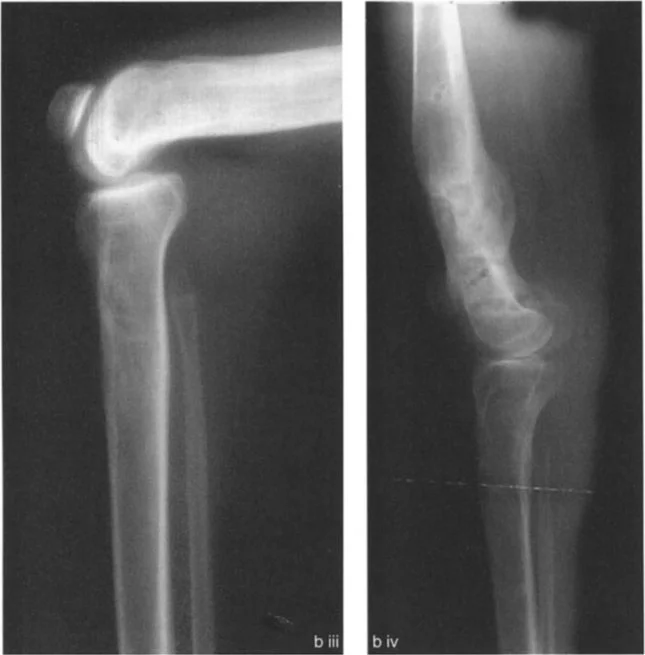 وصف طبي دقيق للمريض