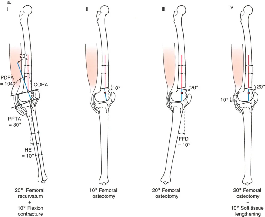 وصف طبي دقيق للمريض