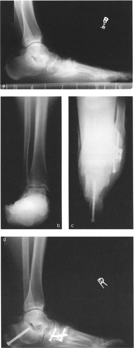 صورة طبية: الاستاذ الدكتور محمد هطيف: دليل شامل لتشوهات قصبة الساق البعيدة والكاحل في صنعاء