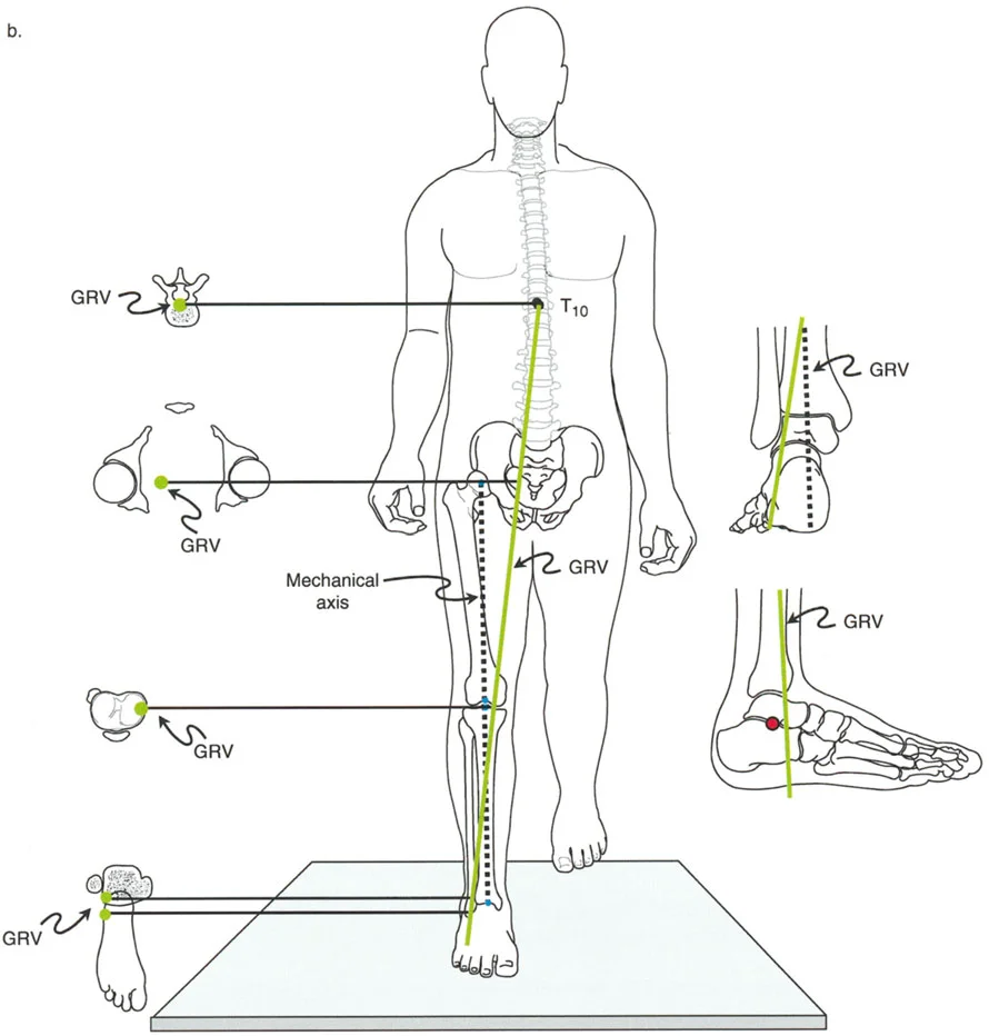 صورة طبية: الاستاذ الدكتور محمد هطيف: دليل شامل لتشوهات قصبة الساق البعيدة والكاحل في صنعاء