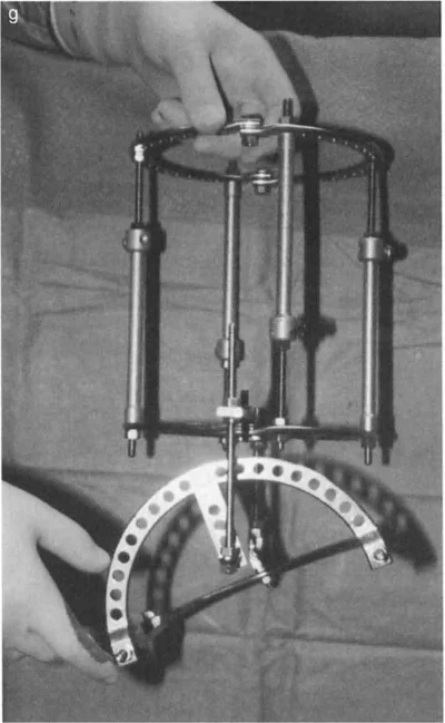 صورة طبية: الاستاذ الدكتور محمد هطيف: دليل شامل لتشوهات قصبة الساق البعيدة والكاحل في صنعاء