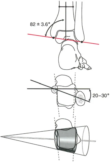 صورة طبية: الاستاذ الدكتور محمد هطيف: دليل شامل لتشوهات قصبة الساق البعيدة والكاحل في صنعاء