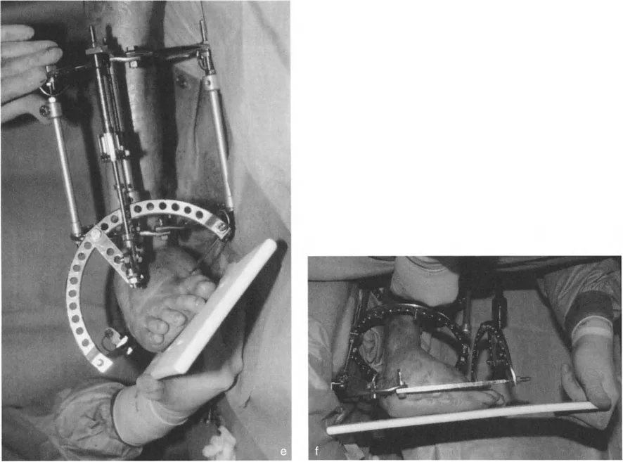 صورة طبية: الاستاذ الدكتور محمد هطيف: دليل شامل لتشوهات قصبة الساق البعيدة والكاحل في صنعاء