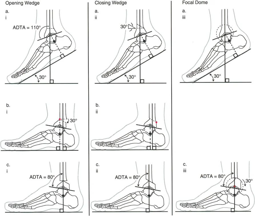 صورة طبية: الاستاذ الدكتور محمد هطيف: دليل شامل لتشوهات قصبة الساق البعيدة والكاحل في صنعاء