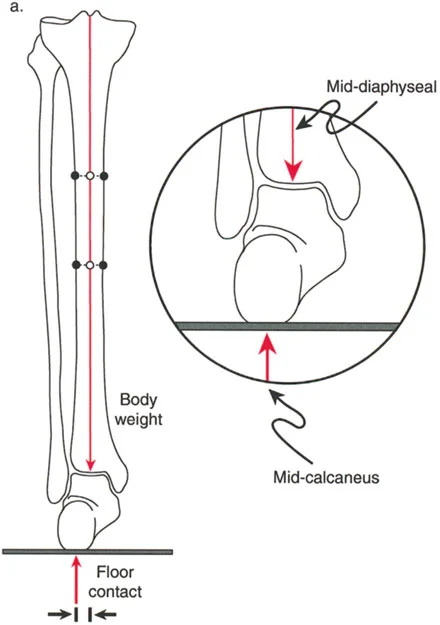 صورة طبية: الاستاذ الدكتور محمد هطيف: دليل شامل لتشوهات قصبة الساق البعيدة والكاحل في صنعاء