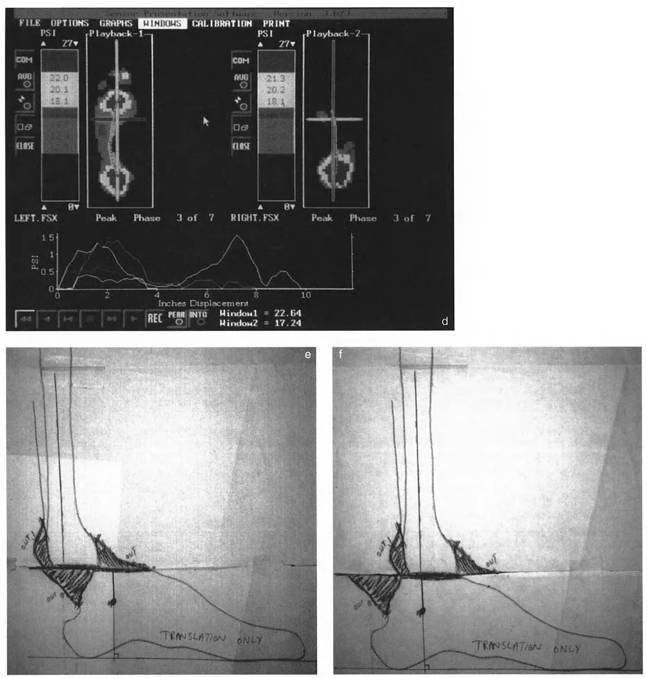 صورة طبية: الاستاذ الدكتور محمد هطيف: دليل شامل لتشوهات قصبة الساق البعيدة والكاحل في صنعاء