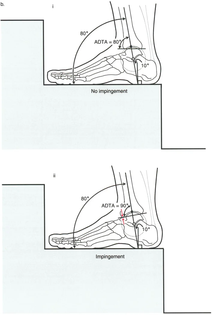 صورة طبية: الاستاذ الدكتور محمد هطيف: دليل شامل لتشوهات قصبة الساق البعيدة والكاحل في صنعاء