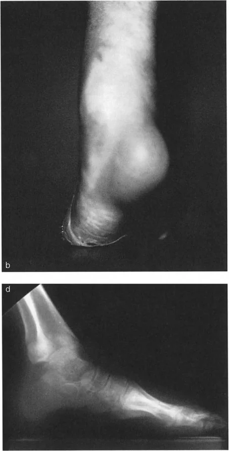 صورة طبية: الاستاذ الدكتور محمد هطيف: دليل شامل لتشوهات قصبة الساق البعيدة والكاحل في صنعاء