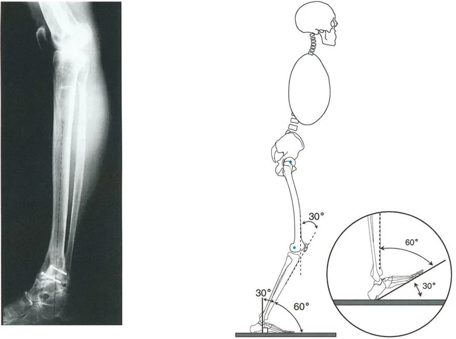 الاستاذ الدكتور محمد هطيف: دليل شامل لتشوهات قصبة الساق البعيدة والكاحل في صنعاء
