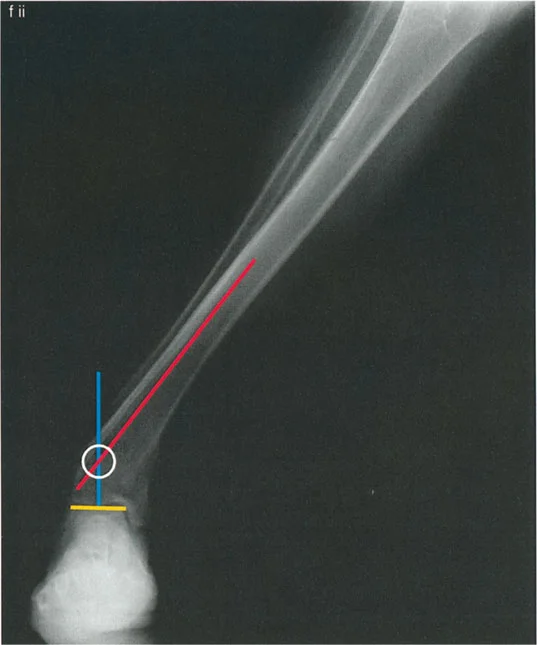صورة طبية: الاستاذ الدكتور محمد هطيف: دليل شامل لتشوهات قصبة الساق البعيدة والكاحل في صنعاء