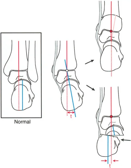 صورة طبية: الاستاذ الدكتور محمد هطيف: دليل شامل لتشوهات قصبة الساق البعيدة والكاحل في صنعاء