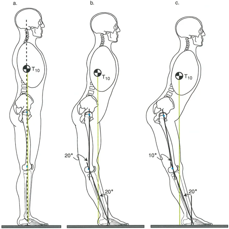 صورة توضيحية لـ الاستاذ الدكتور محمد هطيف: دليل شامل لتشوهات قصبة الساق البعيدة والكاحل في صنعاء