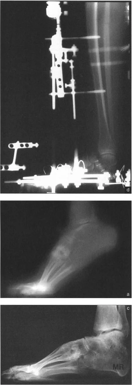 صورة طبية: الاستاذ الدكتور محمد هطيف: دليل شامل لتشوهات قصبة الساق البعيدة والكاحل في صنعاء