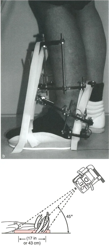 صورة طبية: الاستاذ الدكتور محمد هطيف: دليل شامل لتشوهات قصبة الساق البعيدة والكاحل في صنعاء