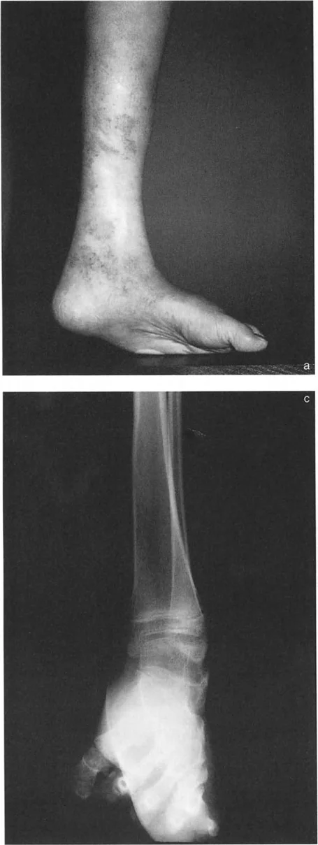 صورة طبية: الاستاذ الدكتور محمد هطيف: دليل شامل لتشوهات قصبة الساق البعيدة والكاحل في صنعاء