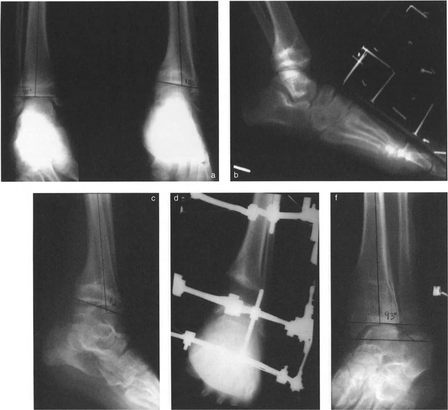 صورة طبية: الاستاذ الدكتور محمد هطيف: دليل شامل لتشوهات قصبة الساق البعيدة والكاحل في صنعاء