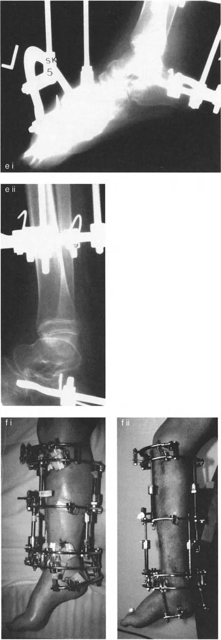 تشوهات الكاحل والقدم: الأسباب، التشخيص، والعلاج المتقدم مع الأستاذ الدكتور محمد هطيف في صنعاء