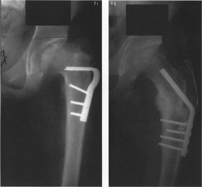 وصف طبي دقيق للمريض