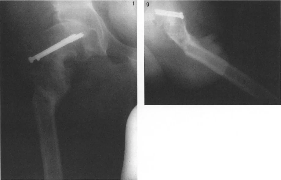 صورة طبية: دليلك الشامل لتصحيح تشوهات مفصل الورك: من التشخيص إلى التعافي مع الأستاذ الدكتور محمد هطيف في صنعاء