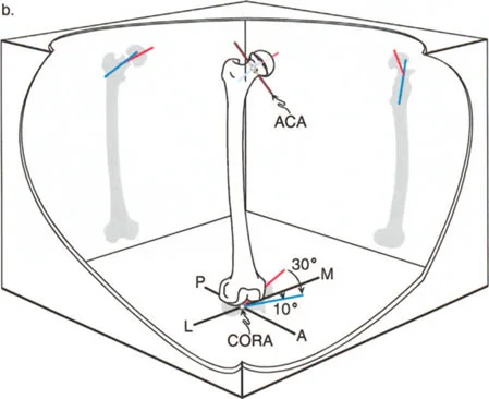 صورة طبية: دليلك الشامل لتصحيح تشوهات مفصل الورك: من التشخيص إلى التعافي مع الأستاذ الدكتور محمد هطيف في صنعاء