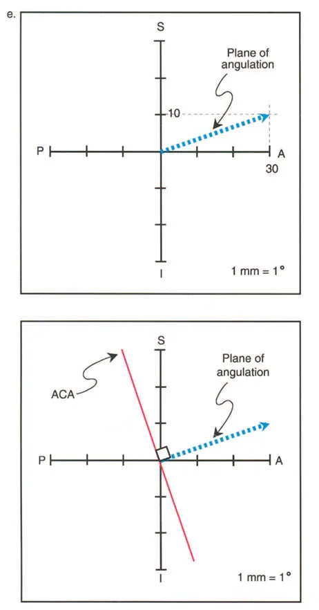 صورة توضيحية لـ دليلك الشامل لتصحيح تشوهات مفصل الورك: من التشخيص إلى التعافي مع الأستاذ الدكتور محمد هطيف في صنعاء