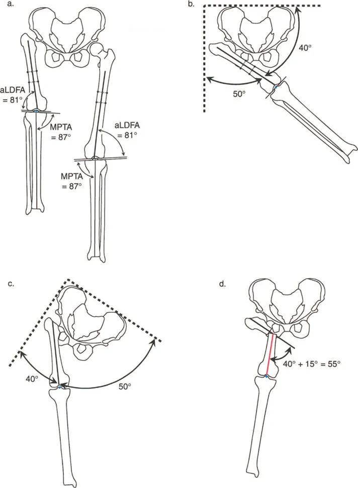 جراحة دعم الحوض العظمية: حلول متقدمة للورك غير المستقر وتصحيح التشوهات مع الأستاذ الدكتور محمد هطيف في صنعاء