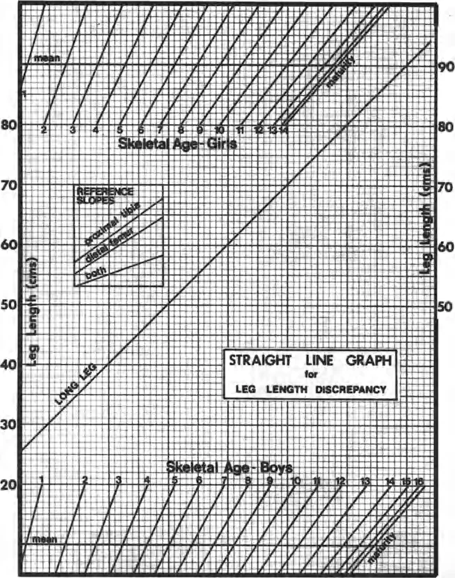 التنبؤ باختلاف طول الساقين عند الأطفال: دليل شامل لنمو العظام ومبادئ بالي مع الأستاذ الدكتور محمد هطيف