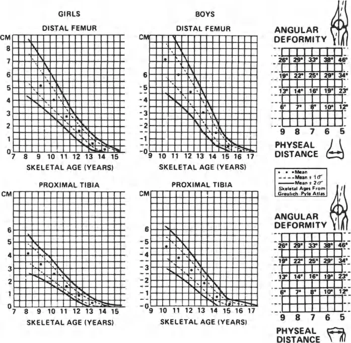 صفائح النمو وتفاوت طول الأطراف: دليل شامل للتنبؤ والعلاج في صنعاء