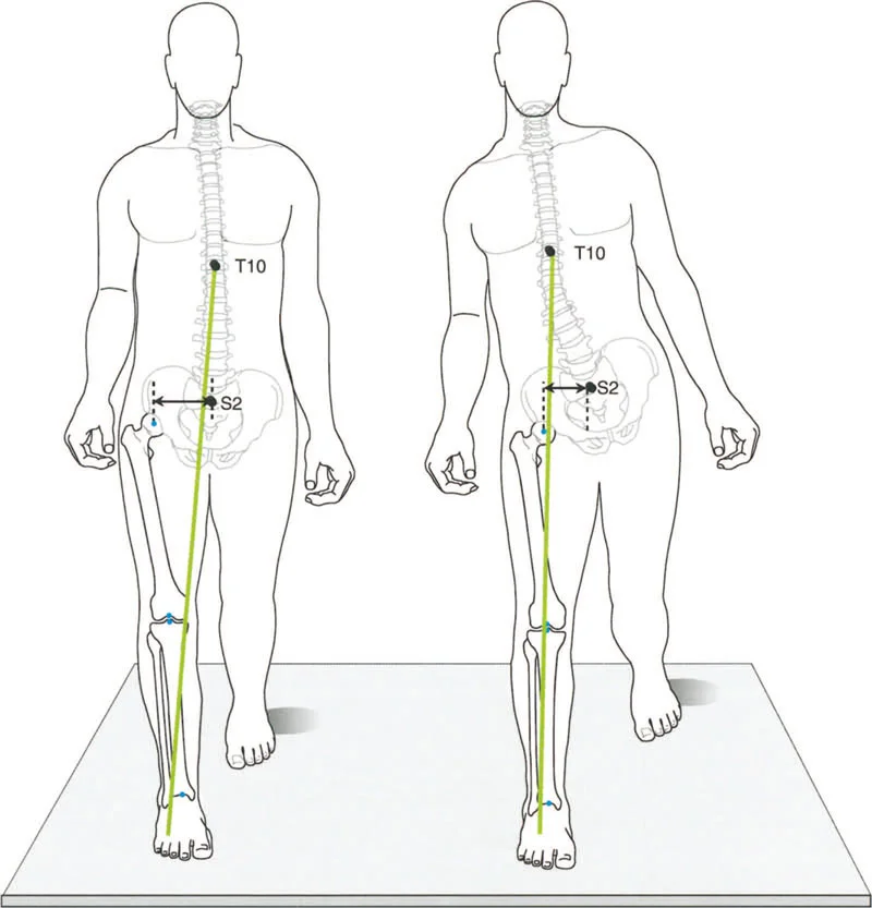 صورة طبية: إتقان ميكانيكا المشي الحيوية وتصحيح تشوهات الأطراف السفلية: نهج الأستاذ الدكتور محمد هطيف في صنعاء