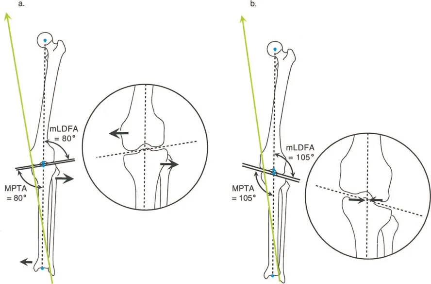 صورة توضح آليات التعويض في المشي