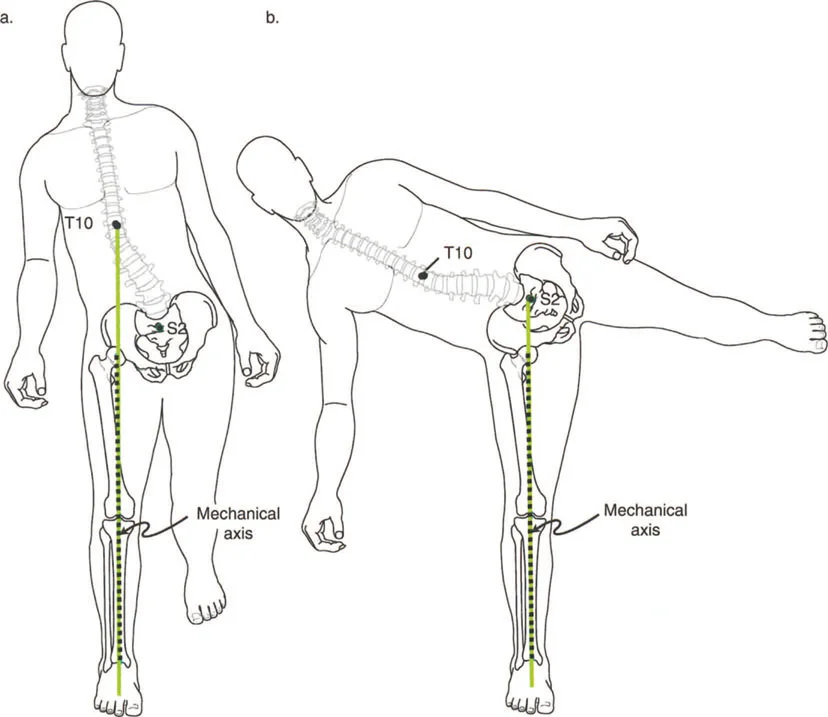 صورة طبية: إتقان ميكانيكا المشي الحيوية وتصحيح تشوهات الأطراف السفلية: نهج الأستاذ الدكتور محمد هطيف في صنعاء
