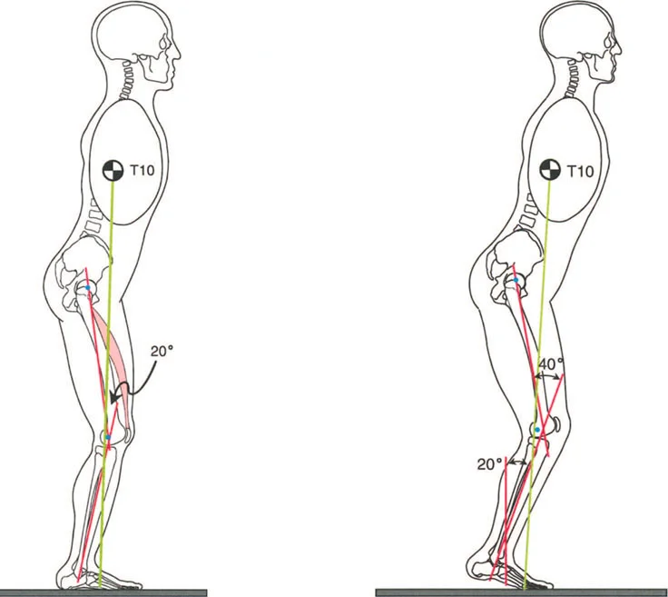مشاكل المشي وتشوهات الركبة والكاحل: دليل شامل لعلاج انحرافات المستوى السهمي مع الأستاذ الدكتور محمد هطيف