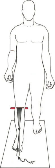 صورة طبية: إتقان ميكانيكا المشي العظمية: دليل شامل لتصحيح التشوهات الديناميكية مع الأستاذ الدكتور محمد هطيف