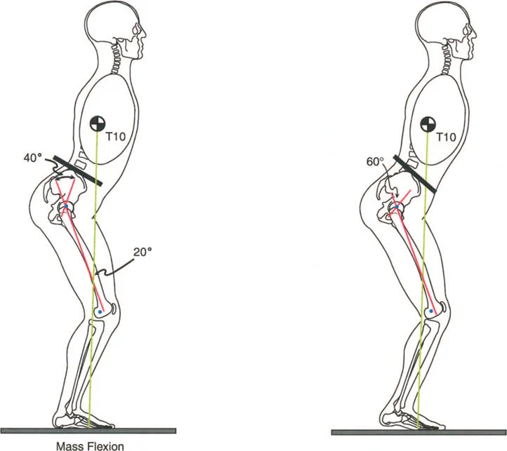 صورة طبية: إتقان ميكانيكا المشي العظمية: دليل شامل لتصحيح التشوهات الديناميكية مع الأستاذ الدكتور محمد هطيف