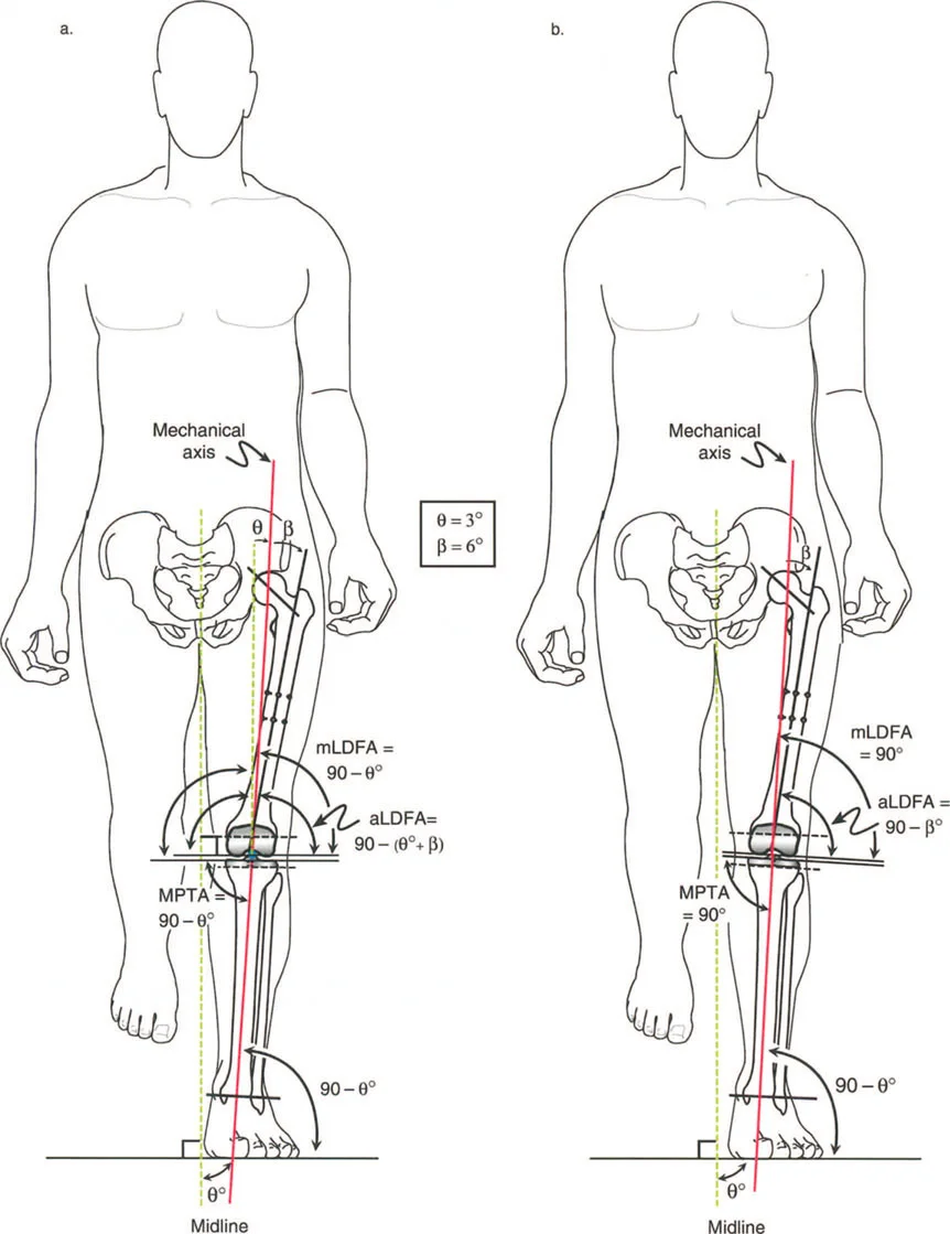 صورة توضيحية لـ فهم وعلاج التشوهات الديناميكية وخلل ميكانيكا الأذرع الرافعة في جراحة العظام مع الأستاذ الدكتور محمد هطيف