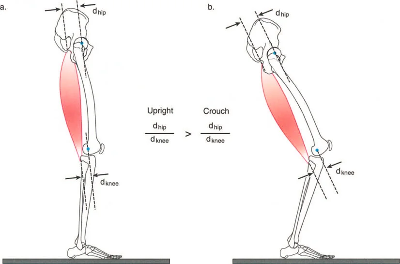 صورة طبية: فهم وعلاج التشوهات الديناميكية وخلل ميكانيكا الأذرع الرافعة في جراحة العظام مع الأستاذ الدكتور محمد هطيف
