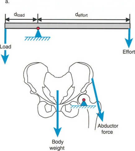 صورة طبية: فهم وعلاج التشوهات الديناميكية وخلل ميكانيكا الأذرع الرافعة في جراحة العظام مع الأستاذ الدكتور محمد هطيف