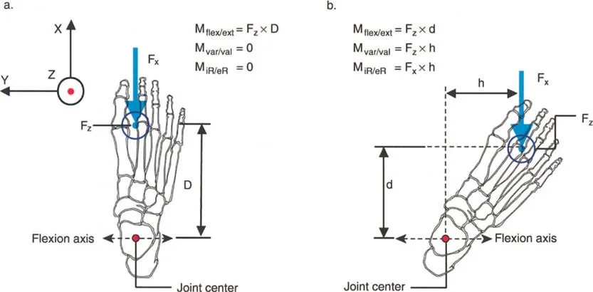 صورة توضيحية لـ فهم وعلاج التشوهات الديناميكية وخلل ميكانيكا الأذرع الرافعة في جراحة العظام مع الأستاذ الدكتور محمد هطيف