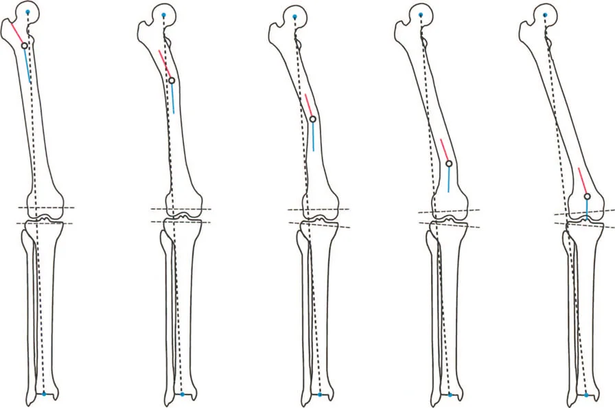 صورة طبية: فهم وعلاج التشوهات الديناميكية وخلل ميكانيكا الأذرع الرافعة في جراحة العظام مع الأستاذ الدكتور محمد هطيف