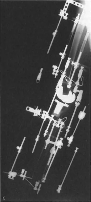 صورة طبية: فهم وعلاج التشوهات الديناميكية وخلل ميكانيكا الأذرع الرافعة في جراحة العظام مع الأستاذ الدكتور محمد هطيف