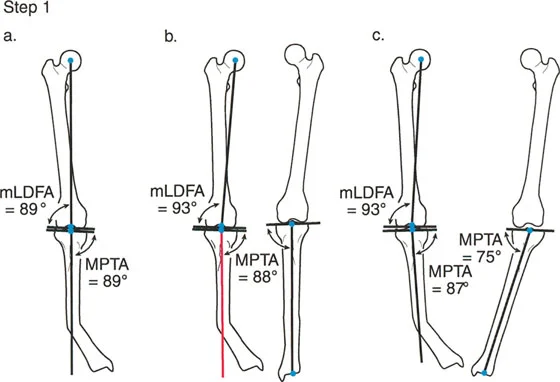 وصف طبي دقيق للمريض