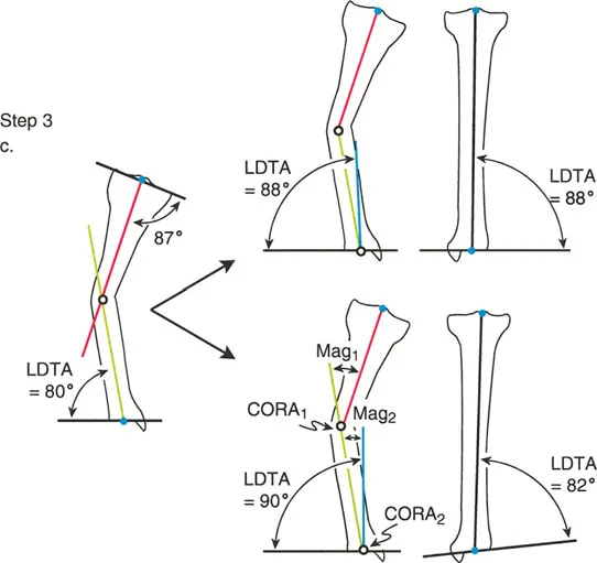 صورة توضيحية لـ تصحيح تشوهات الأطراف السفلية الكلي: دليل شامل للتخطيط الدقيق والعلاج المتقدم في صنعاء مع الأستاذ الدكتور محمد هطيف