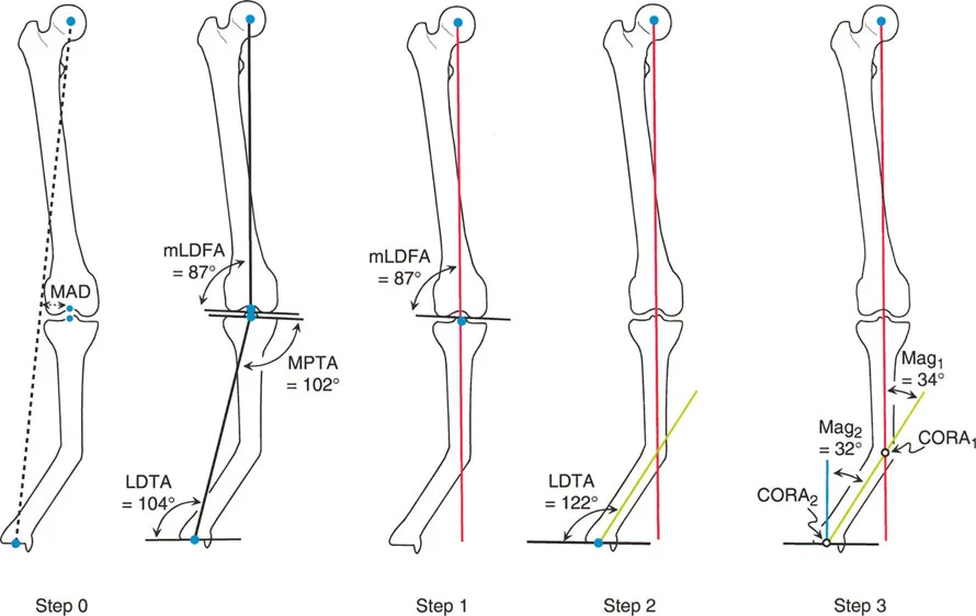 صورة توضيحية لـ تصحيح انحرافات الساقين والأطراف السفلية في صنعاء: دليل شامل مع الأستاذ الدكتور محمد هطيف