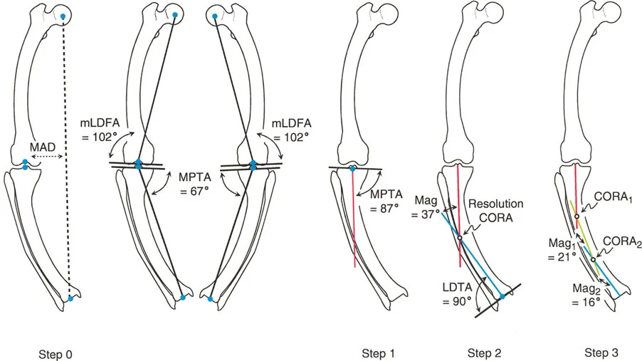 صورة توضيحية لـ تصحيح انحرافات الساقين والأطراف السفلية في صنعاء: دليل شامل مع الأستاذ الدكتور محمد هطيف