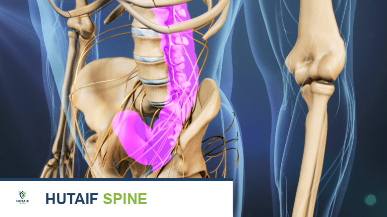 دليل شامل لألم أسفل الظهر الأيسر أسبابه، أعراضه، تشخيصه، وعلاجه مع الأستاذ الدكتور محمد هطيف في صنعاء