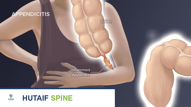 دليلك الشامل لألم أسفل الظهر الأيمن: الأسباب، الأعراض، والحلول الفعالة مع الأستاذ الدكتور محمد هطيف