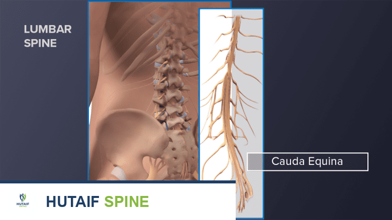 Cauda equina nerves in the lumbar spine.