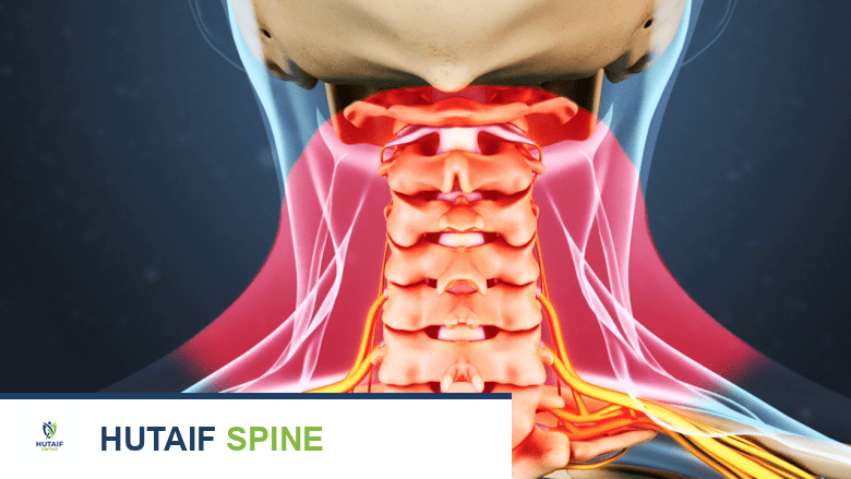 صعوبة التحدث وبحة الصوت بعد جراحة دمج الفقرات العنقية الأمامي (ACDF) كل ما تحتاج معرفته