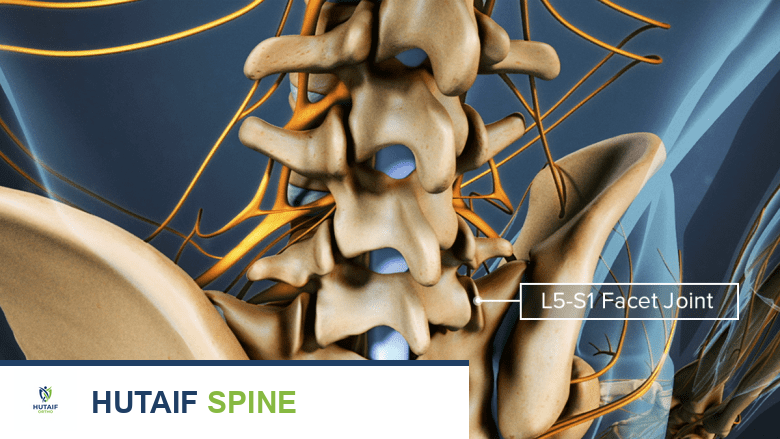 منظر ثلاثي الأبعاد خلفي للعمود الفقري القطني مع تسمية المفاصل الوجيهية L5-S1.
